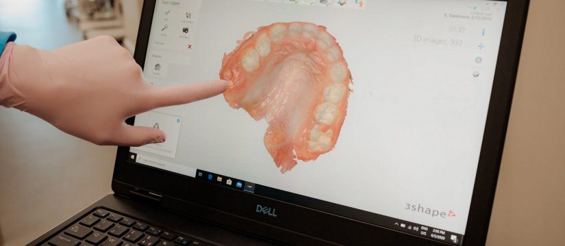 Zobu 3D digitālais attēls_1