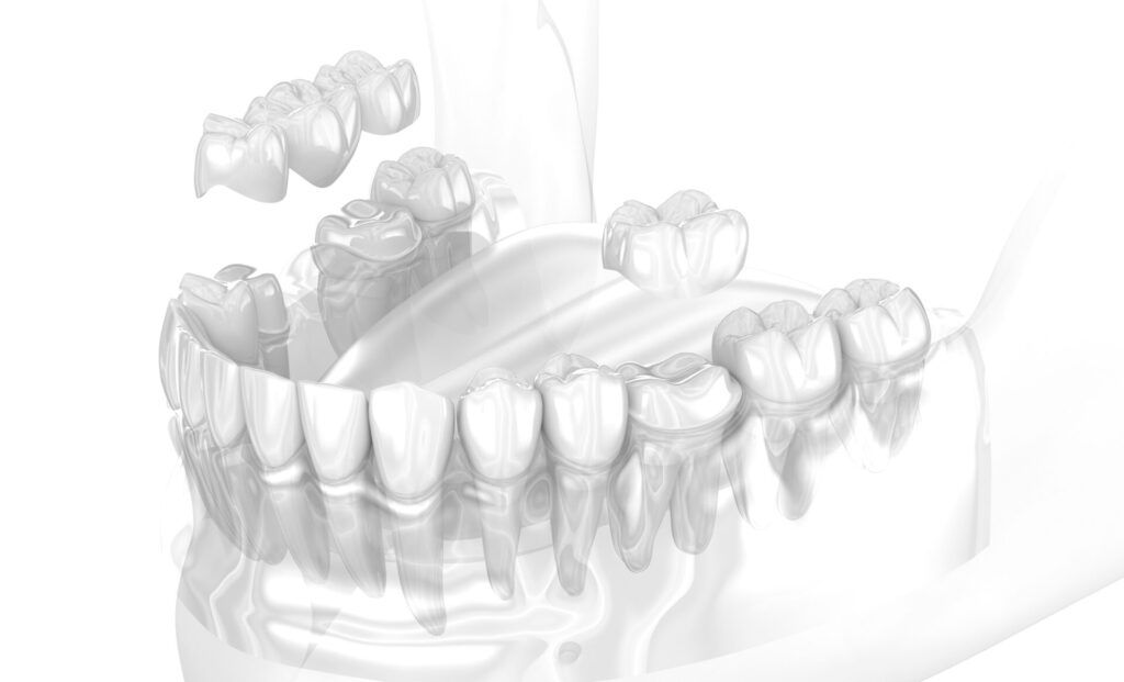 zobu protēzista konsultācija